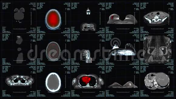 现代放射学CT或CAT检查视频的预览图