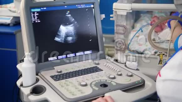 超声波正在对一个小婴儿进行检查视频的预览图