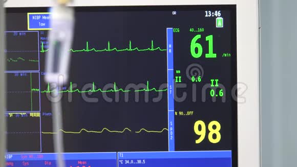 医疗降计和心率监测仪视频的预览图