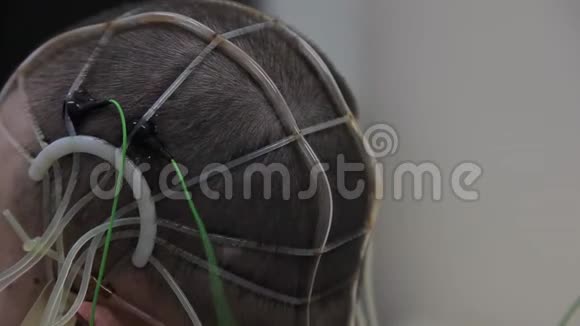 医生把电子传感器连接到病人头上进步医疗技术纳米技术4K视频的预览图