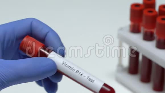 维生素B12试验医生在试管中保存血样健康检查视频的预览图