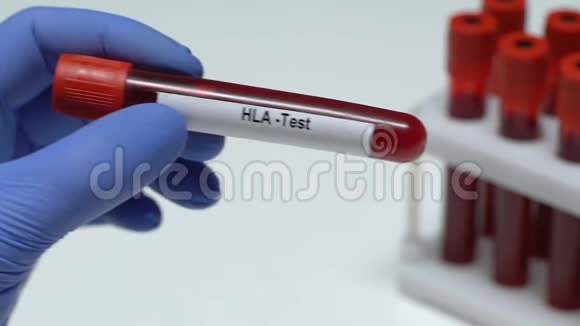 HLATest医生在试管特写中保存血样健康检查视频的预览图