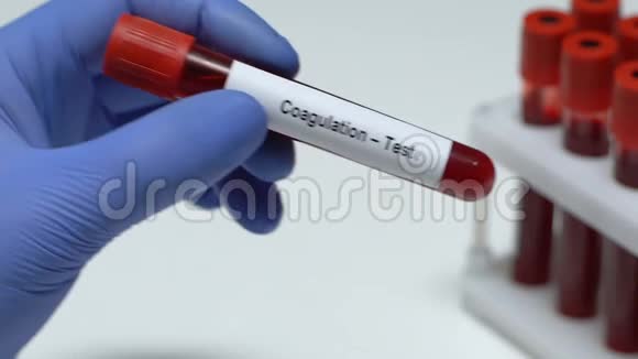 凝血试验医生在试管中进行血液检查健康检查视频的预览图