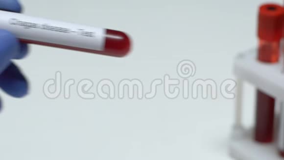 查加斯病试验医生在试管特写镜头中保存血样健康视频的预览图