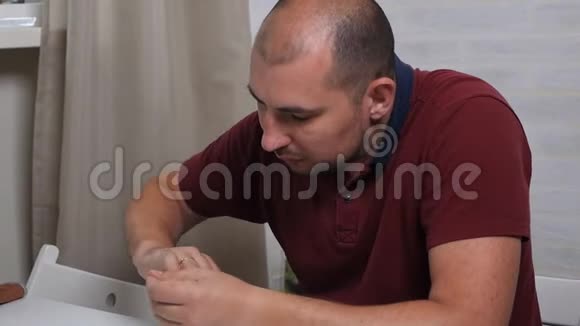 一个可敬的秃头用一种特殊的药物治疗他的指甲以治愈真菌家中手部真菌治疗视频的预览图