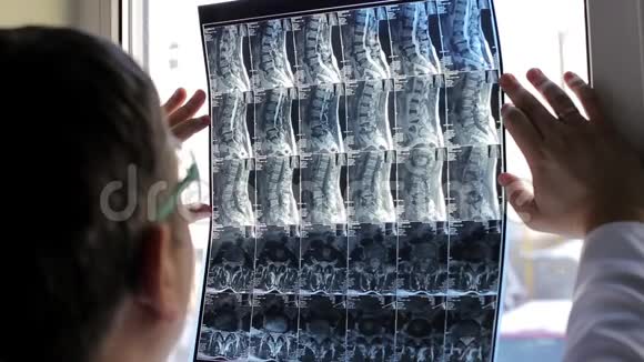 医生在医院检查病人X光视频的预览图