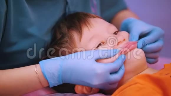 医疗中心脑瘫婴儿接受面部按摩视频的预览图