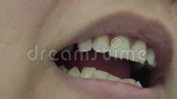 丑丑未刷破牙齿的人视频的预览图