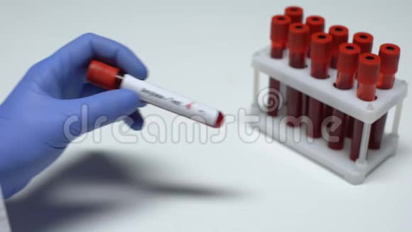淀粉酶检测阴性医生抽血化验健康检查视频的预览图
