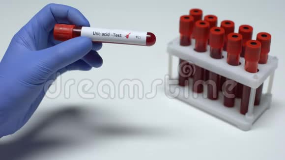 尿酸试验阴性医生做血样化验健康检查视频的预览图