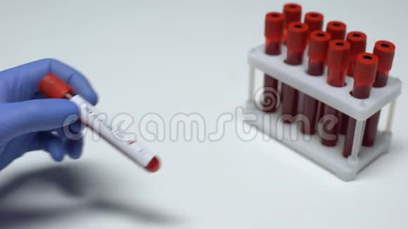 阴性HIV病毒载量测试医生在试管中显示血样实验室研究视频的预览图