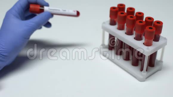 弓形虫试验阳性医生在试管中显示血样实验室研究视频的预览图