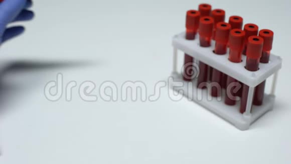 氨试验阴性医生在试管中显示血样实验室研究健康视频的预览图