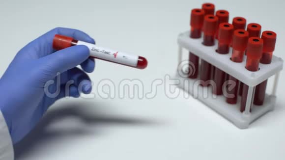 锌试验阴性医生提供血样实验室研究健康检查视频的预览图