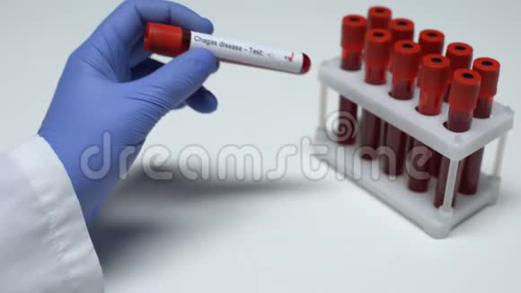 查加斯病试验阳性医生在试管中显示血样实验室研究视频的预览图