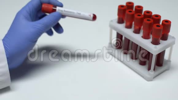 抗药性试验阳性医生在试管中显示血样实验室研究视频的预览图