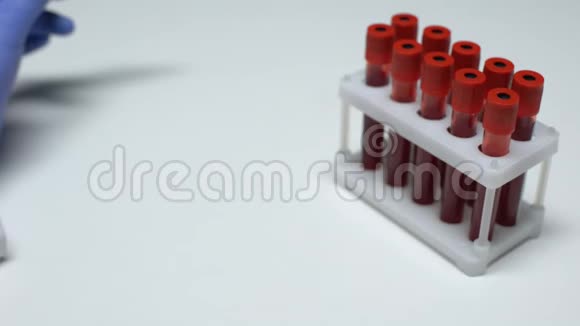 HIV病毒载量检测阳性医生在试管中显示血样实验室研究视频的预览图