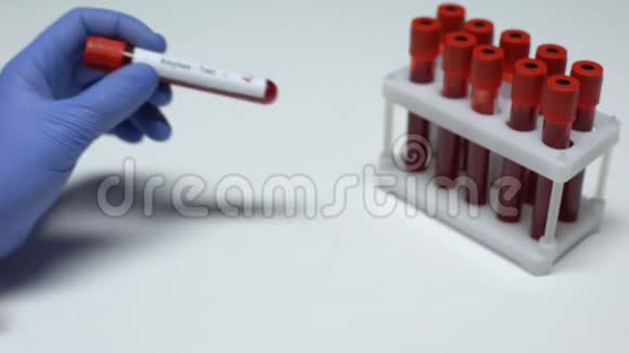 淀粉酶检测阳性医生提供血样实验室研究健康检查视频的预览图