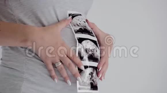 穿灰色衬衫的布鲁内特孕妇摆姿势妈妈做超声波扫描视频的预览图