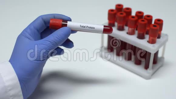 总蛋白医生在试管中显示血样实验室研究健康检查视频的预览图