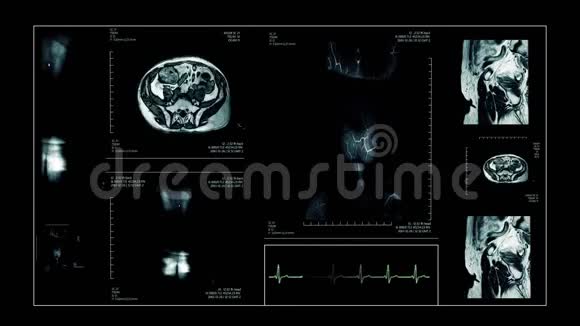 核磁共振活体扫描人体视频的预览图