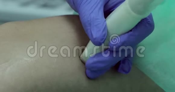 医生在超声检查时引导传感器沿着膝盖表面视频的预览图