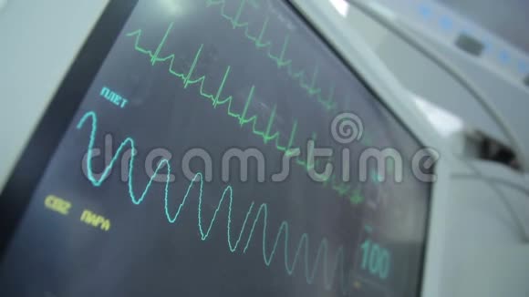 心电监护仪上的数据视频的预览图
