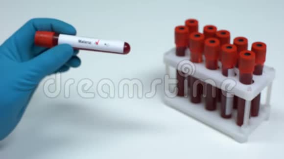 疟疾阴性试验医生提供血样实验室研究医疗保健视频的预览图