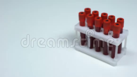 地中海贫血试验阴性医生提供血样实验室研究医疗保健视频的预览图