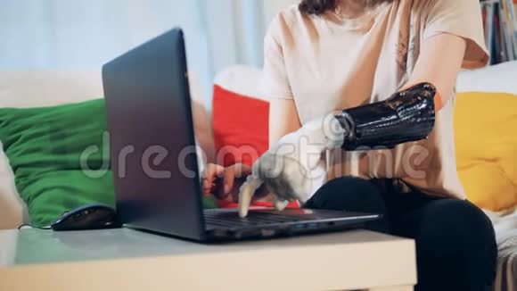 一位手持仿生手的女士正在她的笔记本电脑上打字视频的预览图