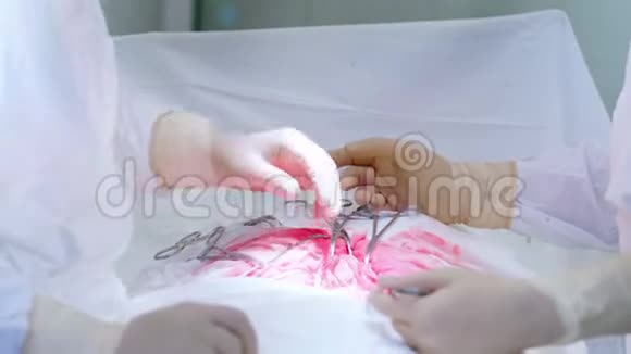 专业医护人员进行腹腔手术的特写视频的预览图