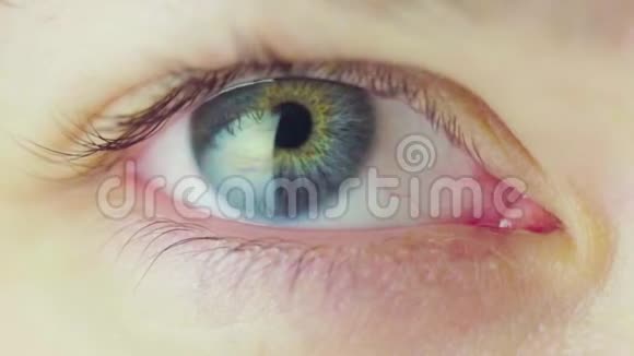 眼科医生的检查概念眼睛跟踪对象视频的预览图