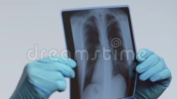 肺心病专家手拿肺X线MRI和医疗支气管炎视频的预览图