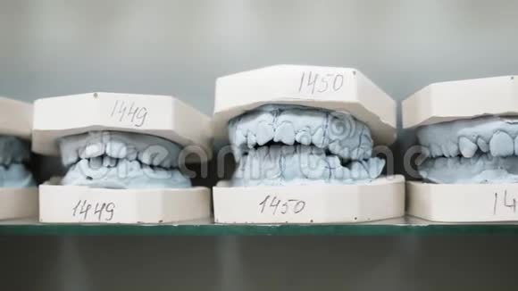 铸造人牙颌的牙科石膏模型视频的预览图