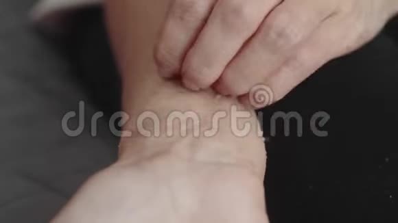 女人用皮炎抓她的手视频的预览图