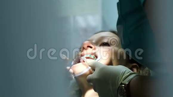 牙科医生在安装托槽系统之前将牙齿的正畸蓝色凝胶放入固定器中视频的预览图