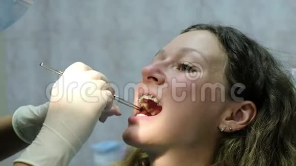 去看牙医正畸医生从病人口中取出追踪纸视频的预览图
