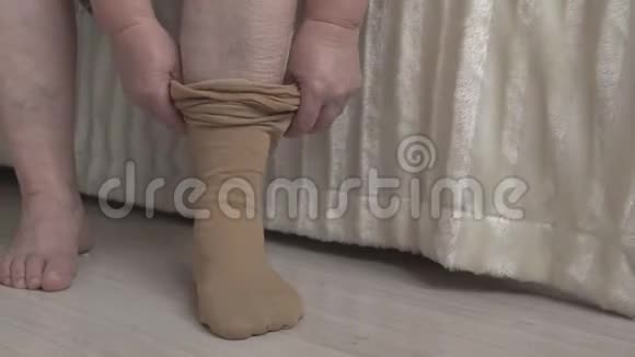 穿着医用长袜的妇女腿上静脉曲张治疗视频的预览图