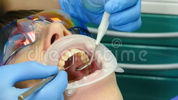 牙科诊所的概念牙科医生用扩张器治疗女性患者的特写镜头现代牙科视频的预览图