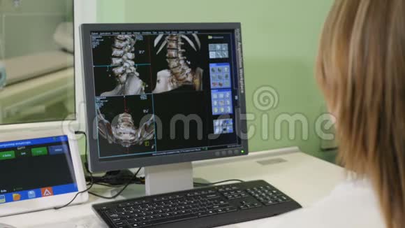 保健概念医院医生看CT扫描女医学科学家工作时肩射视频的预览图