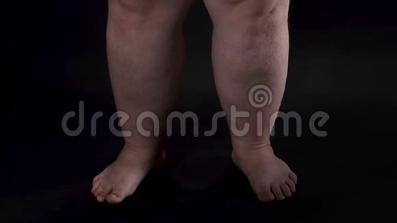 肥胖的男性腿部转向黑暗背景身体护理不健康的营养视频的预览图