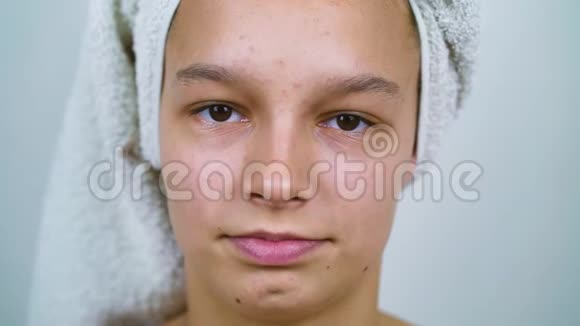 头戴浴巾皮肤有问题的少女画像视频的预览图