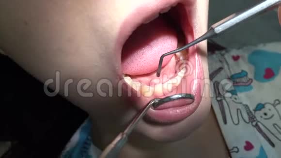 拜访牙医正畸医生口腔的检查视频的预览图