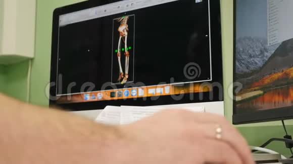 科学家手上的特写镜头在个人电脑上显示指向CTMRI脑扫描图像视频的预览图