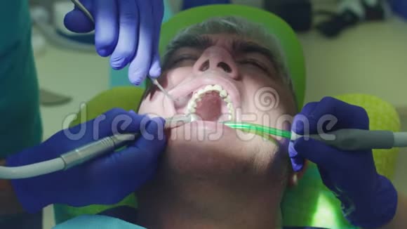 牙科治疗男性患者口腔科把牙科医生的手收起来视频的预览图