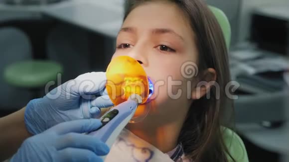 正畸医生用光聚合物灯照在牙齿上视频的预览图