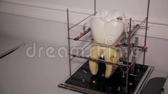 牙齿的模型视频的预览图
