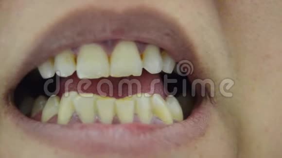 露出丑陋的牙齿的人不刷牙视频的预览图