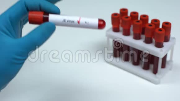 阴性JE病毒检测医生显示血样实验室研究健康检查视频的预览图