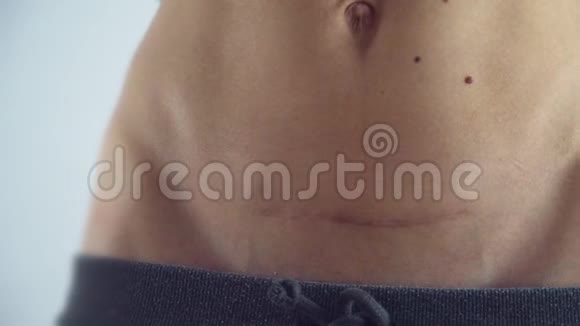 女性腹部贴疤c段对瘦女应用治疗膏药概念4k视频的预览图